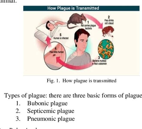 Types Of The Plague Deals Shop | www.pinnaxis.com