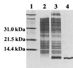 Sdspage Analysis Of Total Cell Protein From E Coli Cells Lane The