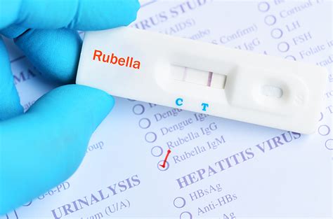 Tes Anti Rubella Igm Tujuan Manfaat Dan Prosedur Halodoc