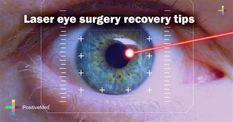 Laser eye surgery recovery tips - PositiveMed