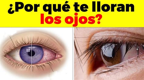 Porqu Me Lloran Los Ojos Causas Y Enfermedades Que Producen