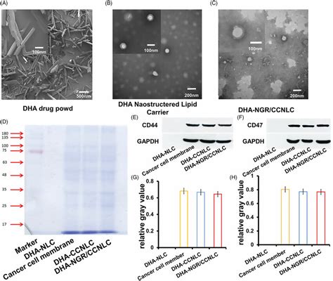 Characterization Of Biomimetic Nanostructured Lipid Carriers A Dha