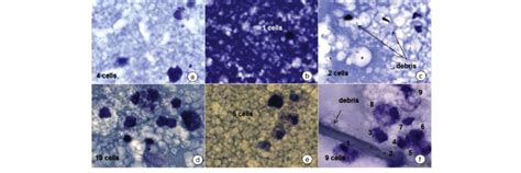 Images Of Somatic Cells From Bovine Milk With Different Backgrounds