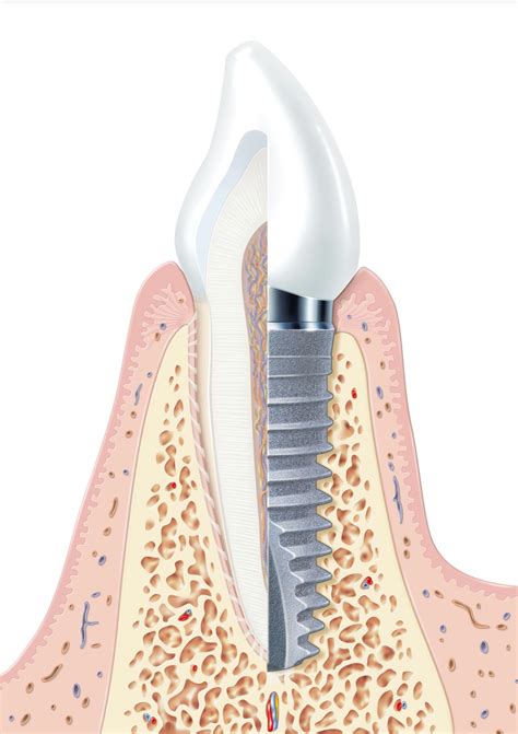 Major renovations at gallions reach shopping park start soon 2