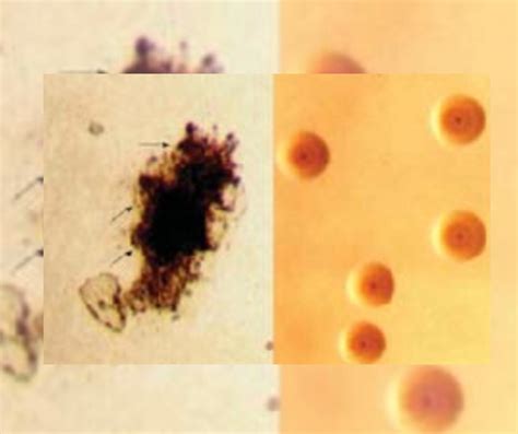 Cultura Para Micoplasma Ureaplasma