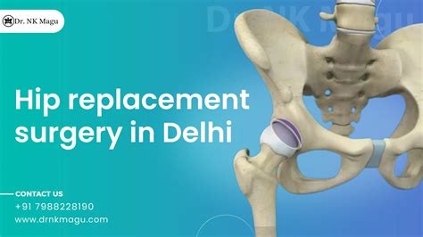 Hip Replacement Surgery Cost In Delhi Dr Nk Magu