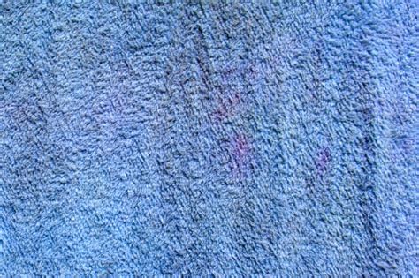 What Causes Pink Stains On Towels