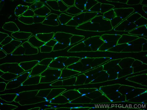 Dystrophin Antibody Ig Proteintech