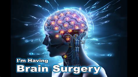 Unemployed Day 1 Brain Surgery Labor Laws YouTube