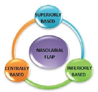 [PDF] Nasolabial flap for reconstruction of Intra-Oral defects ...