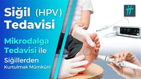 Si Il Tedavisi Hpv Tedavisi Si Il K K Nas L Kar L R I Turan