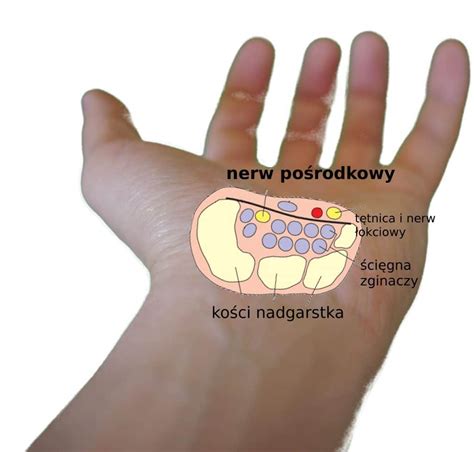 Social Trends Zapalenie Miesni Przyczyny Objawy Leczenie