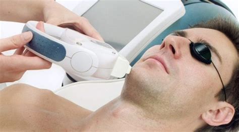 Fotodepila O Masculina Shr Laser E Luz Pulsada Em Ou Zonas Numa