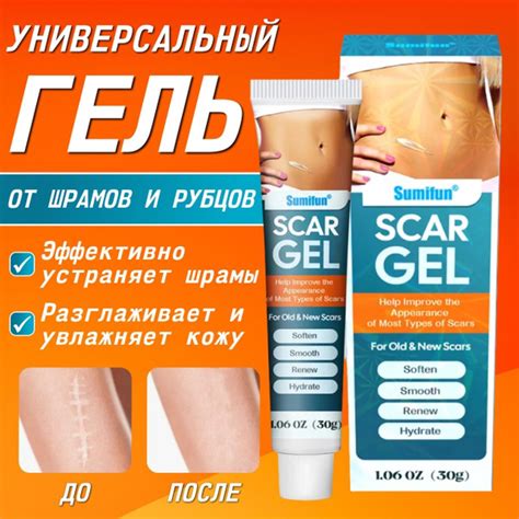 Заживляющий гель от шрамов и ожогов. Крем от рубцов и растяжек. купить ...