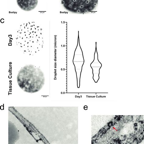 A Confocal Image Of Primary Human Adipocytes Isolated From