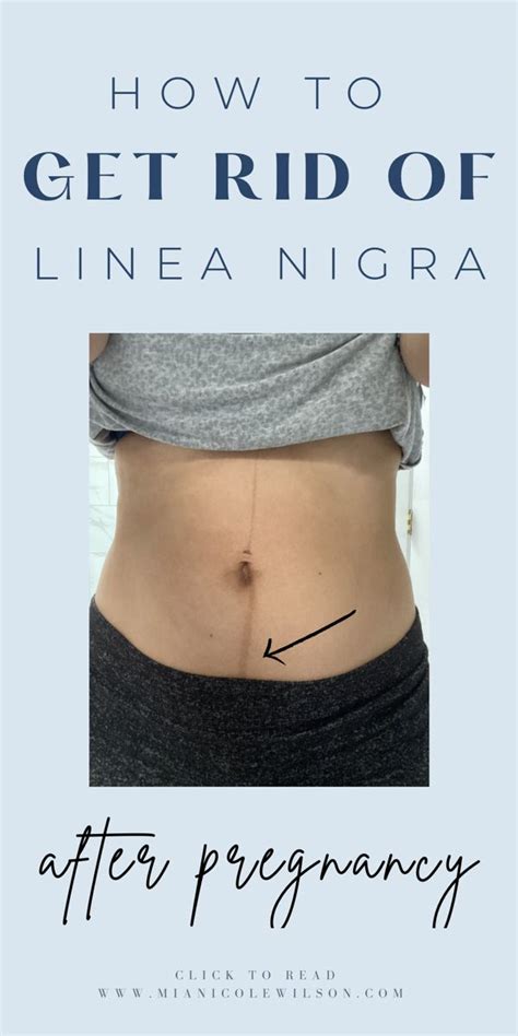 Guide to Getting Rid of Linea Nigra During and After Pregnancy