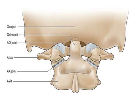 Imaging of atlanto occipital and atlantoaxial traumatic injuries