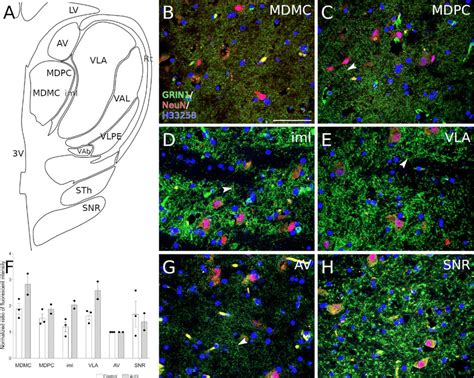 Grin1 Expression In The Human Thalamic Region A Schematic Drawing Download Scientific