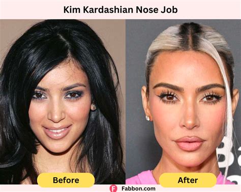 Kim Kardashian Plastic Surgery Secrets - Full Details | Fabbon