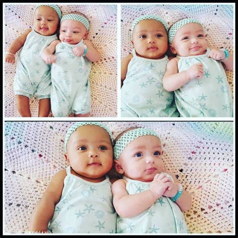 These Rare Biracial Twins Are Winning Hearts All Over The World Closer