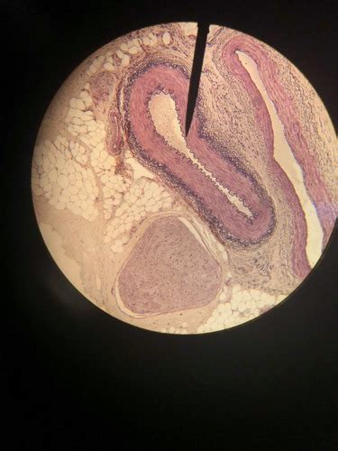 BLOOD VESSEL LAB 1 Flashcards Quizlet