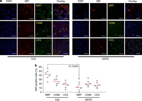 Co Localization Of Macrophage Migration Inhibitory Factor Mif With