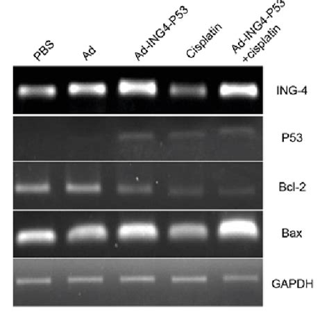 Figure 2 From Co Expression Of ING4 And P53 Enhances Hypopharyngeal