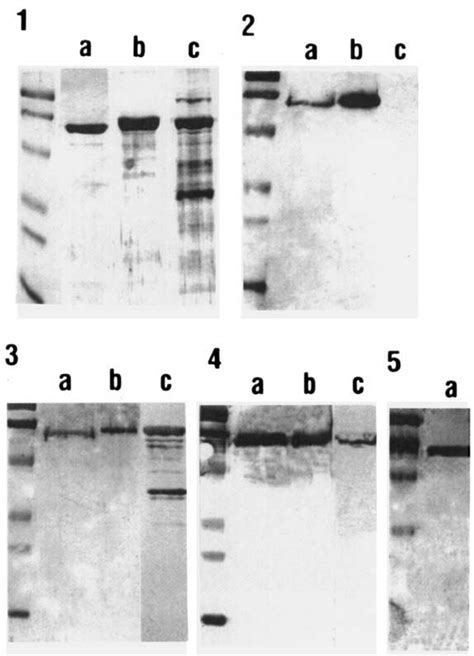 Immunological Cross Reactivity Of Hsp S And Slip Proteins Were