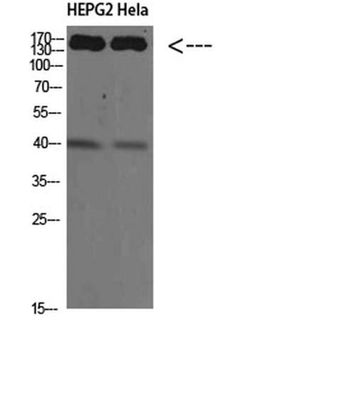 Cyfip Polyclonal Antibody Invitrogen L Unconjugated Cyfip