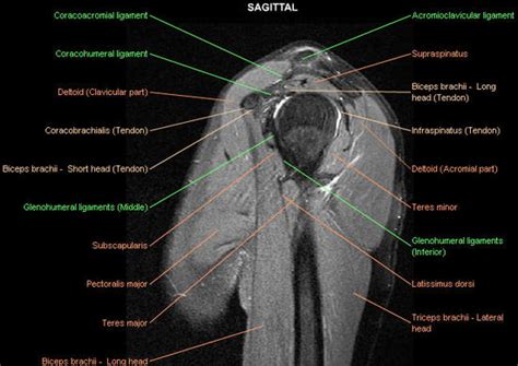 Shoulder Mri Radiographical And Illustrated Anatomical Atlas