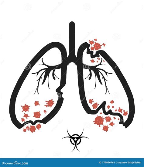 A Danger of Viral Pneumonia Infection. Stock Illustration