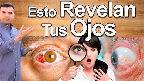 8 Enfermedades Que Revelan Tus Ojos Esto Dicen Tus Ojos Sobre Tu