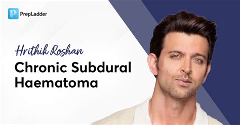 Hrithik Roshan and Chronic Subdural Haematoma