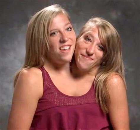 Conjoined Twins Abby And Brittany Hensel Break Silence After Surprise