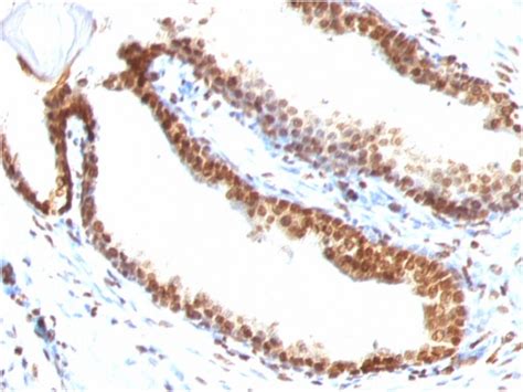 Double Stranded Dna Dsdna Monoclonal Antibody Dsd 958 Msm3 958 P1abx