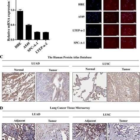 Tmem196 Expression Was Significantly Downregulated In Lung Cancer Cells