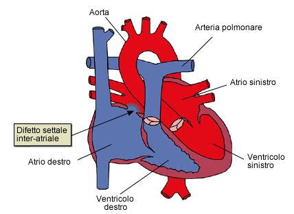 Cardiochirurgia Pediatrica Centro Cuore