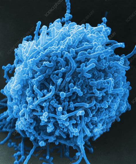 Mycoplasma Bacteria SEM Stock Image C028 2514 Science Photo Library