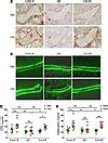 JCI Sex Steroid Deficiencyassociated Bone Loss Is Microbiota Dependent And Prevented By