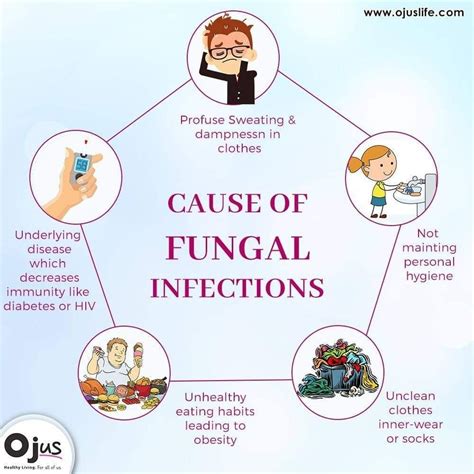 Fungal Infection Causes | Hot Sex Picture