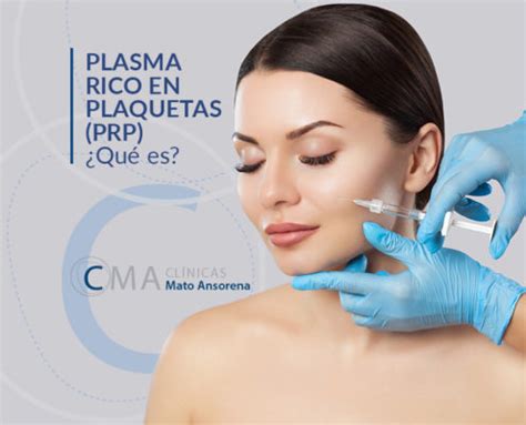 Bioestimulaci N Con Plasma Rico En Plaquetas Prp Cl Nicas Mato Ansorena