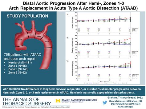 Distal Aortic Progression After Hemiarch Zones 1 3 Arch Replacement In