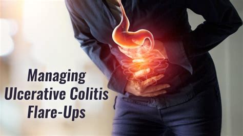 Tips On How To Manage An Ulcerative Colitis Flare-up?