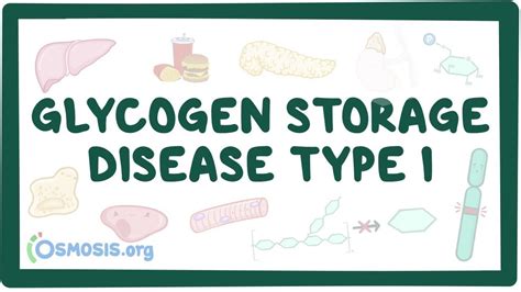 Glycogen Storage Disease Types Mnemonic Dandk Organizer