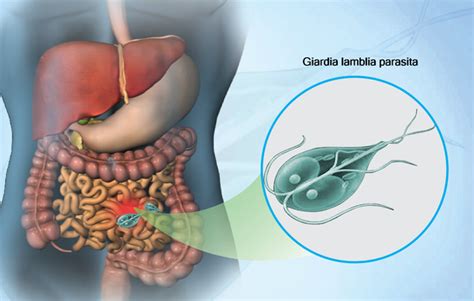 Health Condition Symptoms Causes Treatment And More