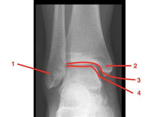 Anatomy Of Calcaneus And Surrounding Joints Flashcards Quizlet