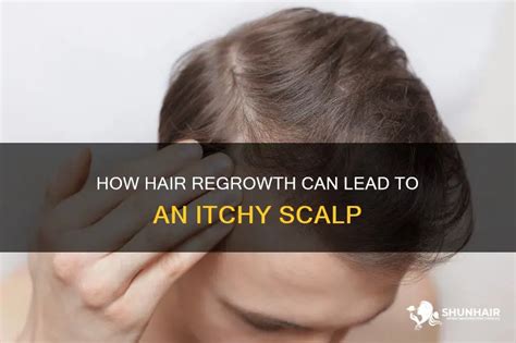 How Hair Regrowth Can Lead To An Itchy Scalp Shunhair