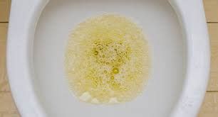 Why Urine that Looks Like Bubbly Beer Can Mean Serious Disease » Scary ...