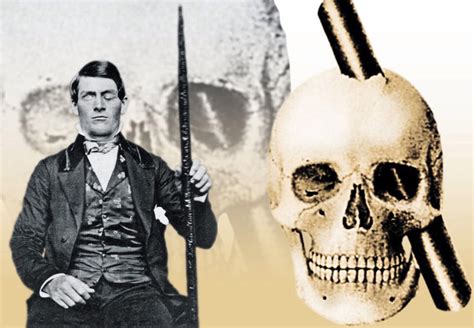 Frontaal Syndroom Phineas Gage