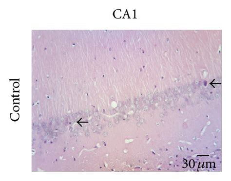 Histopathological evaluation of hippocampus in rats treated with zinc ... 